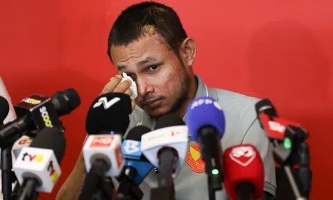 Đội trưởng ĐT Malaysia lần đầu lộ diện sau vụ tạt axit kinh hoàng