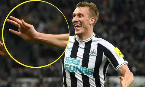 CĐV tò mò lý do sao Newcastle chỉ có 9 ngón tay