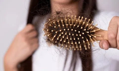 Tránh xa nước nóng và 7 bí kíp ngăn rụng tóc mùa đông cần làm ngay để cứu vãn mái tóc
