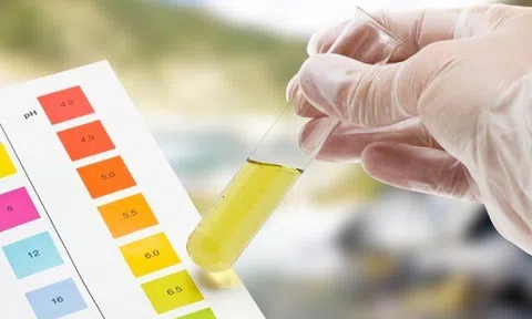 Đã giải mã được bí ẩn 'tại sao nước tiểu có màu vàng' sau 150 năm tìm kiếm