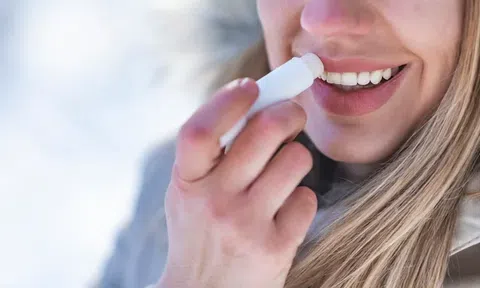 Tại sao môi lại nứt nẻ vào mùa đông?