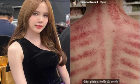 Thiều Bảo Trâm tiết lộ tình hình sức khoẻ khiến fan lo lắng