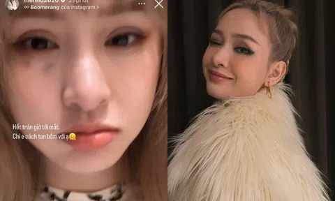 Hiền Hồ gây chú ý với vết bầm lớn trên mặt, netizen thở dài ngao ngán