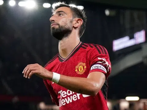 Điểm lại loạt xế sang của chàng tiền vệ Manchester Utd - Bruno Fernandes