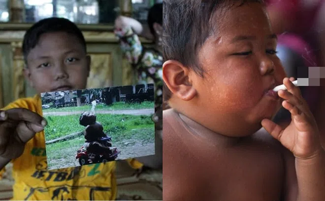 Cậu bé 2 tuổi hút 40 điếu thuốc/ngày khiến cả thế giới kinh ngạc bây giờ thế nào?