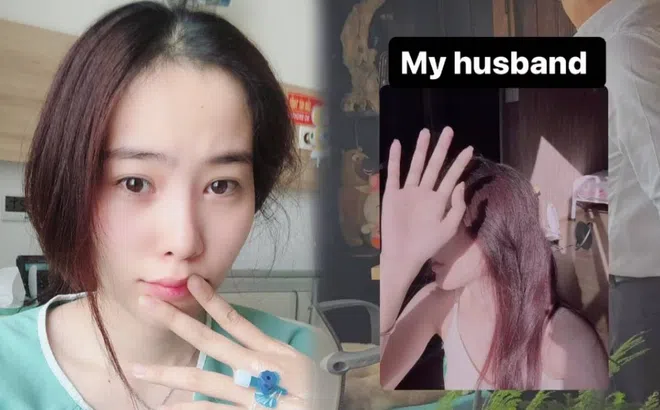 Báo tin vui chưa lâu, Nam Em nay gây lo lắng khi hiện diện với thân hình bầm tím