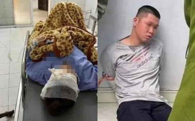 Chi tiết nóng vụ cô dâu Thái Bình bị người yêu cũ chém trong ngày cưới: 3 nhát vào mặt, bị tấn công khi đứng chờ nhà trai