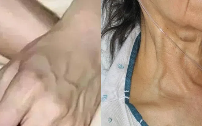 Trên tay càng nhiều gân thì càng... Phụ nữ nhất định phải xem điều này!