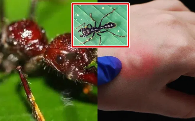 Loài kiến ​​độc nhất thế giới, ai bị cắn thì có cảm giác như bị đạn bắn!