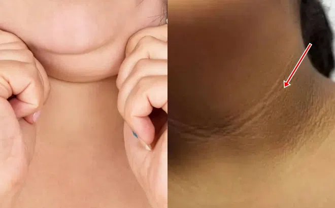 Một người có thể sống được bao lâu nếu nhìn vào cổ mình? Những người có tuổi thọ cao thường có những đặc điểm này ở cổ!