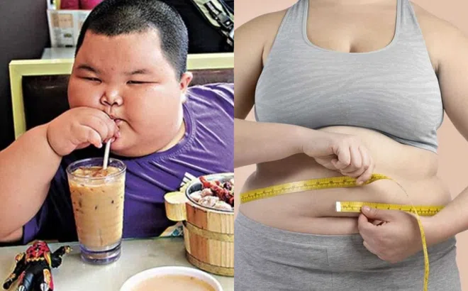 Thế giới có bao nhiêu người béo phì? Con số sẽ khiến bạn phát hoảng!