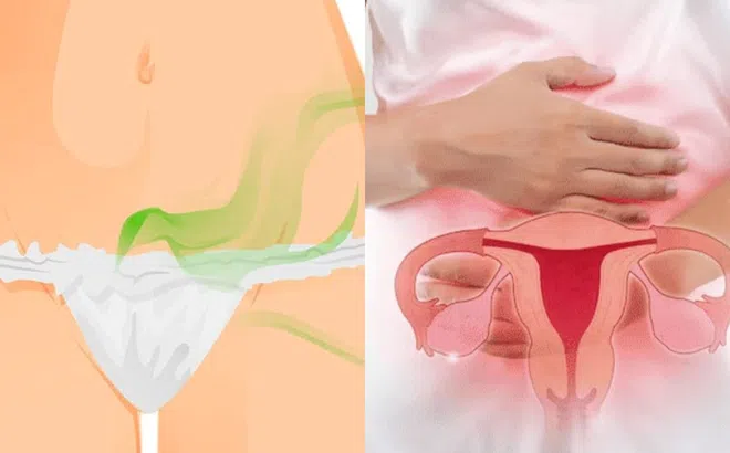 Tại sao 'cô bé’ lại có mùi lạ khi quan hệ? Cẩn thận nguy hiểm đằng sau!