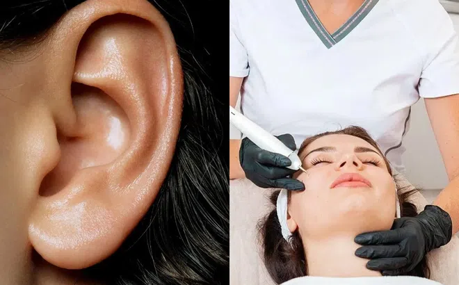 Nếu có nốt ruồi ở 4 nơi này thì đừng dại mà xóa đi nếu không sẽ mất phúc và gặp hoạ!