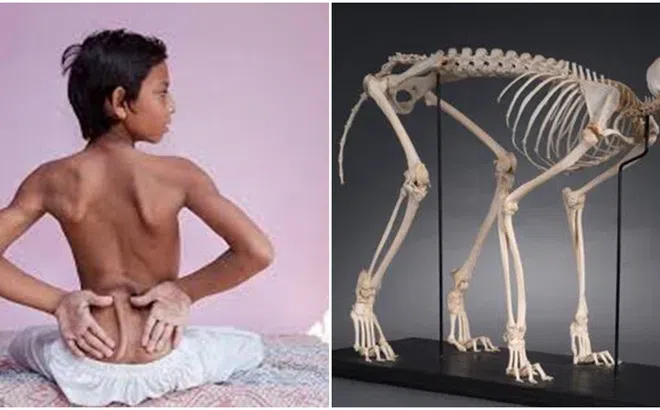 Hé lộ lý do con người mất đuôi vào 25 triệu năm trước