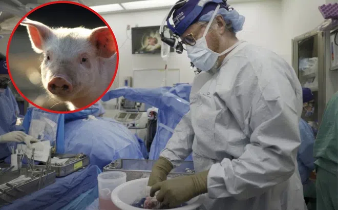 Cấy ghép thận lợn sang người thành công, hoạt động tốt trong 1 tháng và chưa có dấu hiệu dừng lại