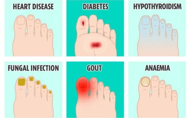 Chân lạnh là bị làm sao? 6 biểu hiện lạ của chân cần đi khám bác sĩ chứ đừng chờ tự khỏi