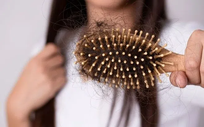 Tránh xa nước nóng và 7 bí kíp ngăn rụng tóc mùa đông cần làm ngay để cứu vãn mái tóc