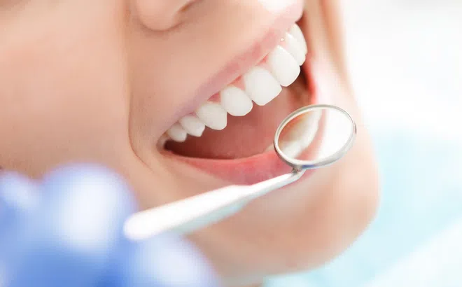 Ăn gì tốt cho răng? 5 thực phẩm nên ăn và cần tránh để bảo vệ sức khỏe răng miệng