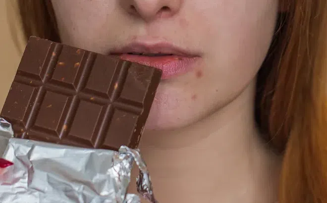 Đường có phải là nguyên nhân chính gây ra mụn trứng cá?