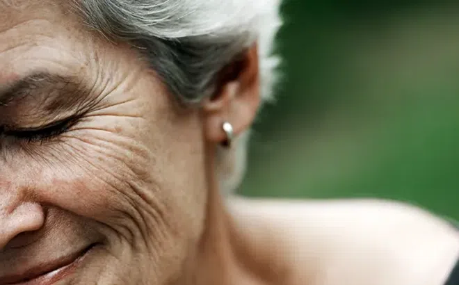 Tại sao khi già lại có nếp nhăn? Người da trắng có nếp nhăn sớm hơn người da sẫm màu?